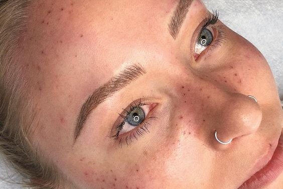 Freckle tattoos