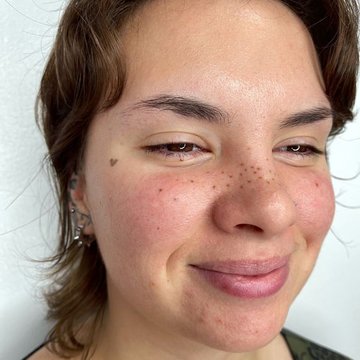 Freckle tattoos