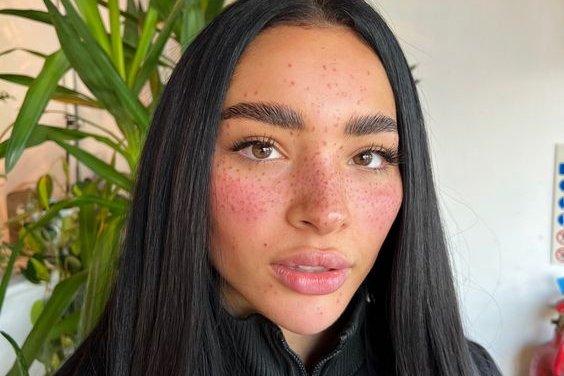 Freckle tattoos