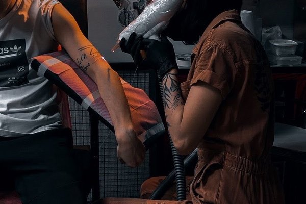 Laser tattoo removal in Walsall