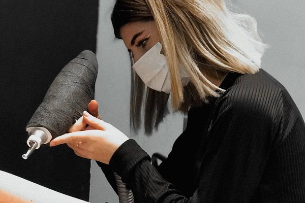 tattoo removal