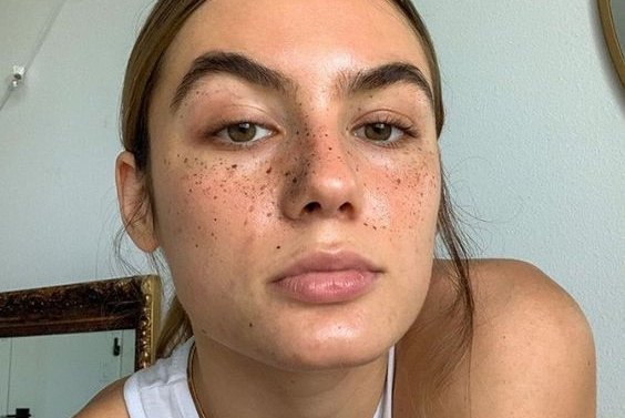 Freckle tattoos